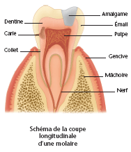 Schéma d'une molaire