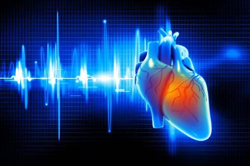 Insuffisance cardiaque