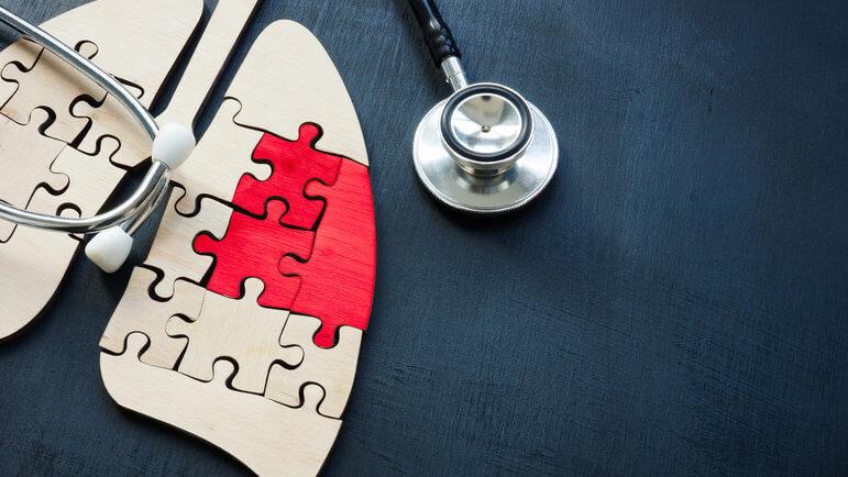 Les cancers du poumon chez les femmes et du pancréas continuent leur progression.