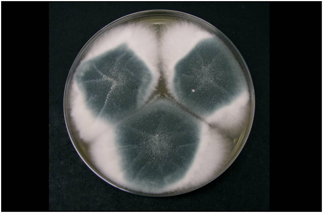 Aspergillus fumigatus en culture (@ Dr David Midgley, Wikimedia)