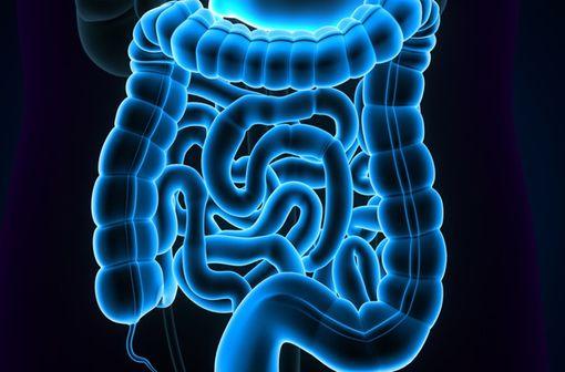 Le cancer colorectal (CCR) se situe au troisième rang des cancers les plus fréquents en France chez l’homme et au deuxième rang chez la femme (illustration).