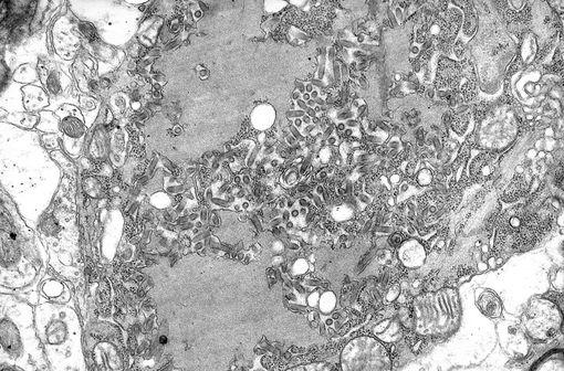 Virions de la rage (petits bâtonnets gris sombre) et corps de Negri (inclusions cellulaires plus larges pathognomoniques de la rage) en micrographie (illustration @Bibliothèque d'images de santé publique sur Wikimedia).