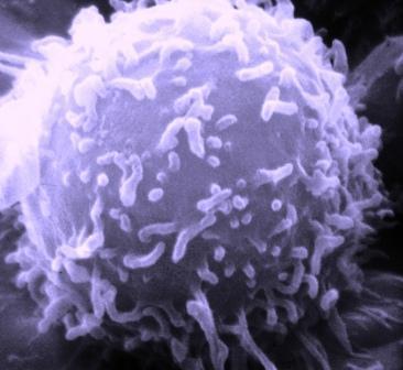 Lymphocyte humain en microscopie électronique (© Wikimedia).