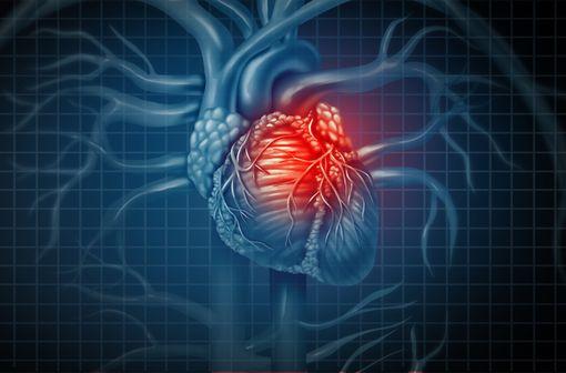 METALYSE est un traitement thrombolytique indiqué chez les adultes en cas de suspicion d'infarctus du myocarde (illustration).