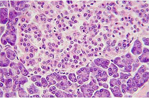 Aspect en microsopie d'une coupe de tissu pancréatique montrant un îlot de Langerhans (illustration @Polarlys, sur Wikimedia).