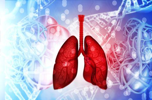 L’emphysème par déficit génétique en alpha-1 antitrypsine est une forme rare de bronchopneumopathie chronique obstructive (illustration).