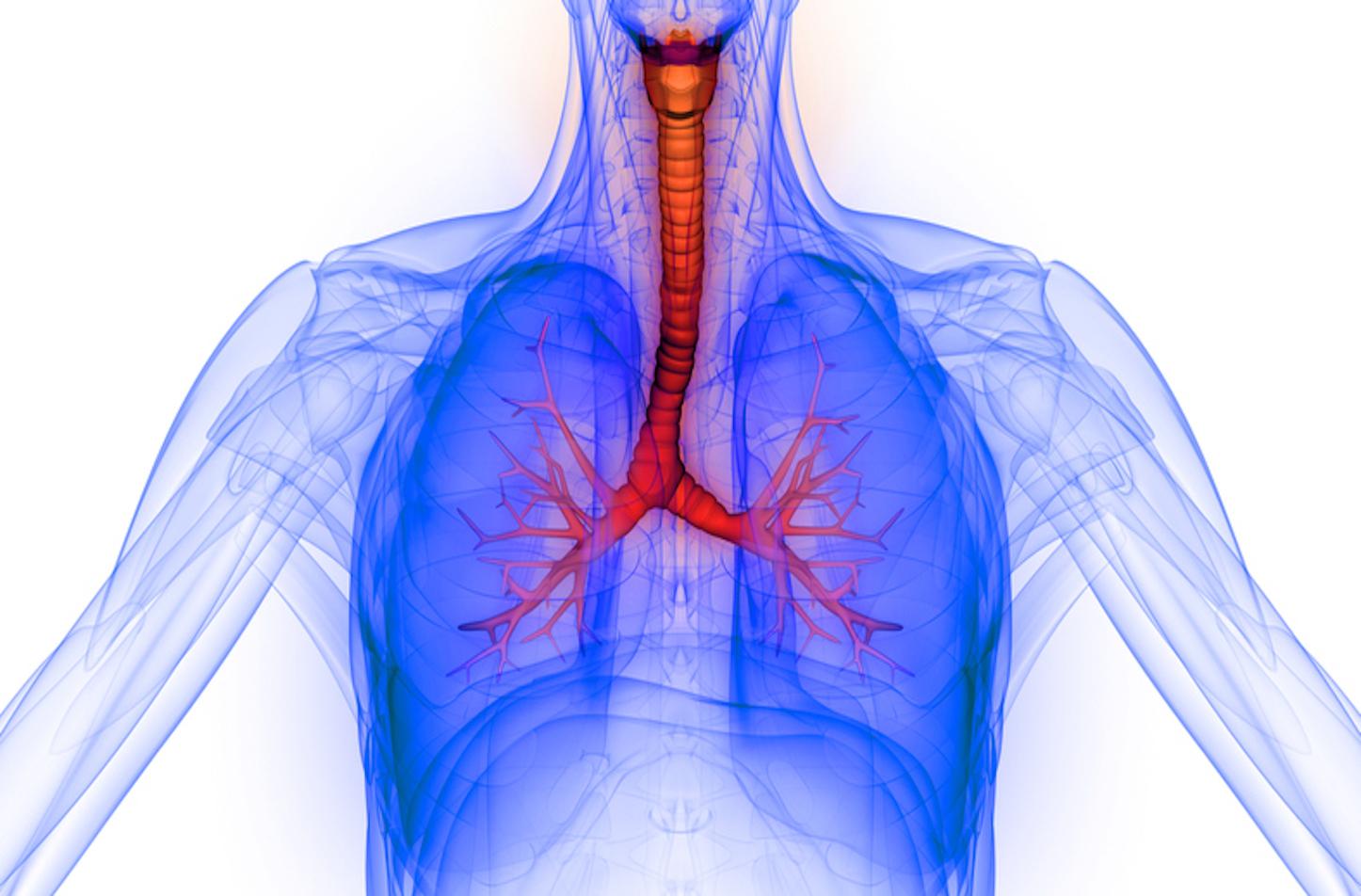 RESPREEZA est indiqué dans le traitement d'entretien du déficit sévère et documenté en alpha-1 antitrypsine chez les adultes afin de ralentir la progression de l'emphysème (illustration).