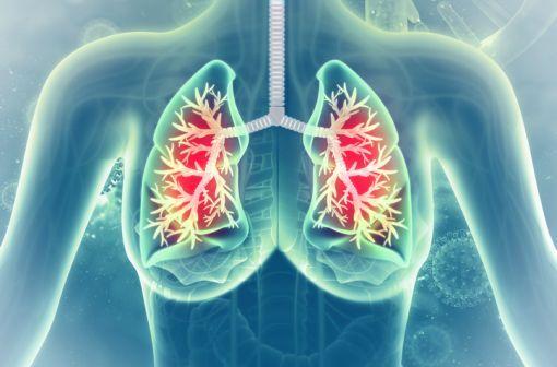 Le montélukast est indiqué en traitement additif de l'asthme léger à modéré, insuffisamment contrôlé par une corticothérapie (illustration).