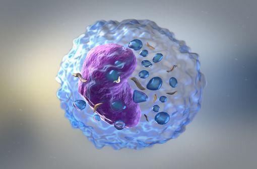 La leucémie lymphoïde chronique est caractérisée par l’accumulation de lymphocytes B d’aspect matures, avec envahissement sanguin et médullaire (illustration).